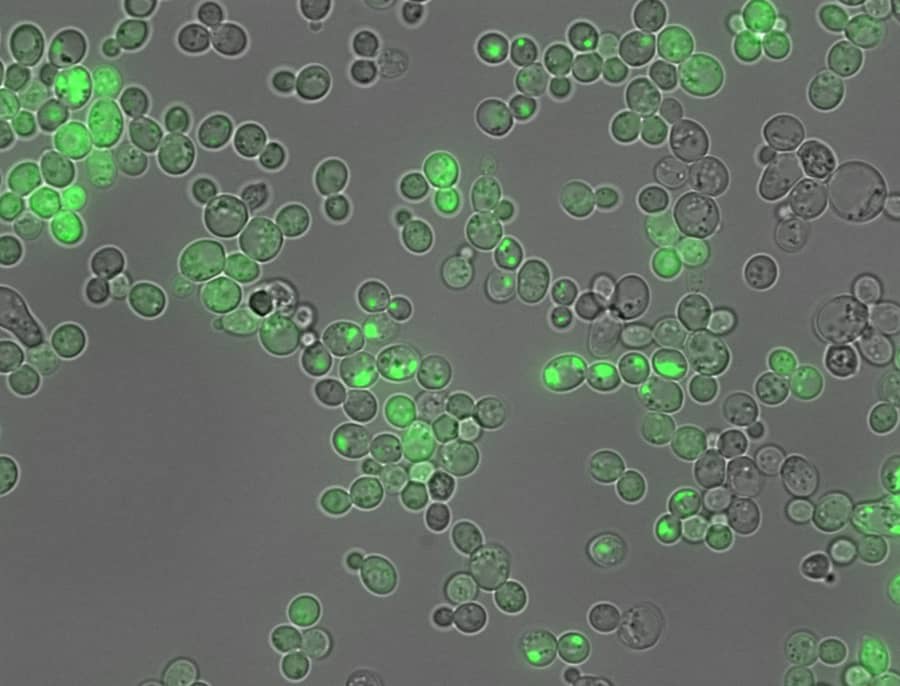Una IA traduce el lenguaje de las proteínas vinculadas al alzhéimer