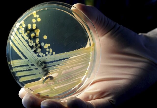 superbacterias