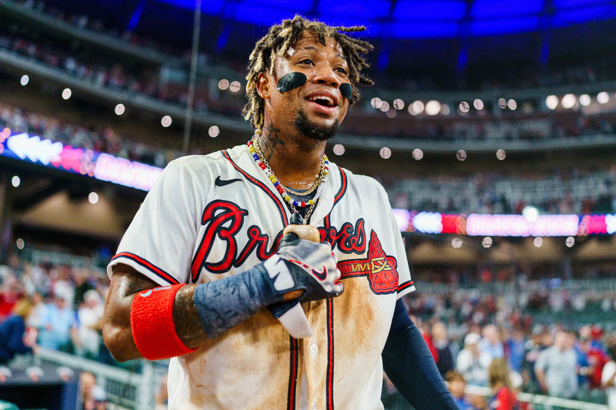 Acuña Jr. podría volver a jugar en mayo